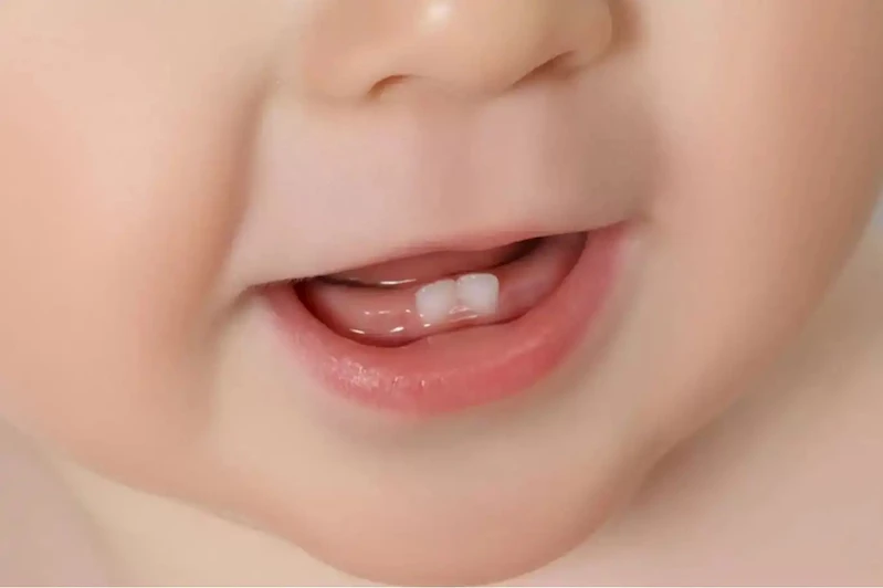 Diş sağlığı için erken yaşta önlem alınmalı